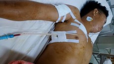 Bắt đối tượng liên tiếp gây ra 2 vụ đâm chém người trong đêm