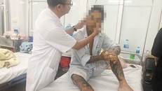 Nam thanh niên nhiễm viên gan B nghi do ‘nghiện’ xăm trổ