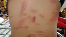 Tạm giữ hình sự người cha đánh con gái 6 tuổi bằng khúc sắt