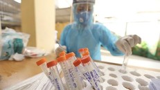 Nhân viên y tế làm công tác xét nghiệm. (Ảnh: TTXVN/Vietnam+)