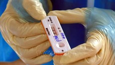 Người đã nhiễm chủng Omicron vẫn có thể tái nhiễm lần nữa với chính Omicron, nhưng với biến thể phụ khác. Ảnh: TTXVN.