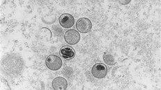 Hình ảnh virus đậu mùa khỉ dưới kính hiển vi. (Ảnh: AFP/TTXVN)