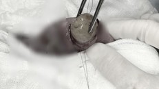 Cảnh báo nguy hiểm khi trẻ nuốt đồ chơi hạt nở