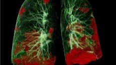 Ảnh minh họa (Nguồn: Reuters.)