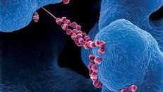 Vi khuẩn liên cầu lợn lây sang người như thế nào?