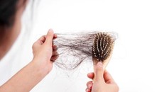 Cảnh báo xu hướng trẻ hóa bệnh rụng tóc