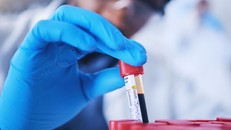 Chỉ cần xét nghiệm máu có thể dự báo sớm bệnh tim di truyền phổ biến nhất thế giới