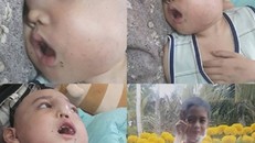 Sau cú ngã, bi kịch ập đến với bé trai khôi ngô, tuấn tú