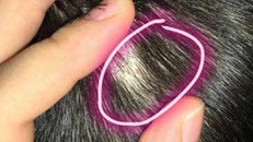 Phẫn nộ 5 cô giáo dùng kim đâm khắp người trẻ mầm non