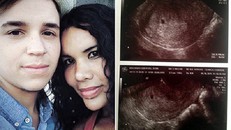 Chồng mang thai nhờ tinh trùng của vợ