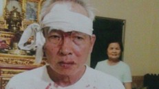 Tin mới nhất vụ trưởng thôn bị côn đồ hành hung vì tố cáo sai phạm
