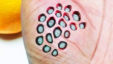 Lý giải hội chứng sợ những cái lỗ Trypophobia của con người