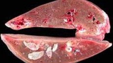 Con vật to bằng ngón tay rình rập ăn lá gan của bạn