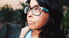 Trường hợp được cho là 'ma cà rồng' đầu tiên trên thế giới