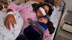 Kinh hoàng chồng tra tấn, cắt mũi vợ như thời trung cổ