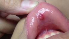 Vợ tới cơ quan tìm chồng trị tội vì tưởng mình mắc bệnh tình dục