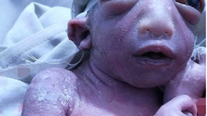 Hoảng hồn 'em bé ngoài hành tinh' sinh ra tại Ấn Độ