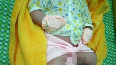 Bé trai sơ sinh có cân nặng 'khủng' 5,1kg ở Quảng Nam