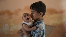 Kinh hãi virus gây tật đầu nhỏ ở trẻ sơ sinh đang lan rộng