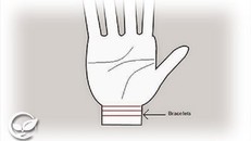 Số vòng hằn trên cổ tay cảnh báo bệnh, tuổi thọ của bạn