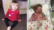 Cái chết của bé 2 tuổi viêm màng não cảnh tỉnh các bậc cha mẹ