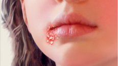 Mẹ đòi tự tử khi biết con 2 tuổi lây bệnh lậu từ bố