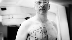 Bi hài chuyện người đàn ông bị ung thư vú