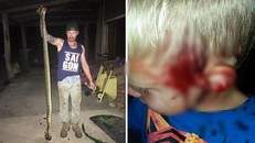Kinh hãi phát hiện trăn 3 mét cắn cậu bé 6 tuổi khi đang ngủ