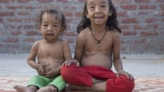 Nỗi tuyệt vọng của hai chị em bỗng dưng hóa thành người già