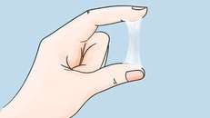 Những dấu hiệu của 'huyết trắng' cảnh báo sức khỏe của bạn