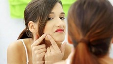 Cách nặn mụn trứng cá an toàn nhất không để lại sẹo