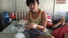 Vụ nữ sinh bị mất chân 'oan': Trường hợp bị hoại tử chân rất ít