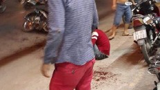 Nhận diện côn đồ truy sát chém lìa tay thanh niên giữa Sài Gòn