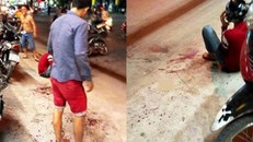 Nghi can chém lìa tay thanh niên khai do mâu thuẫn tình cảm 