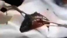 Bác sĩ gắp cá rô còn sống từ cổ họng bệnh nhân