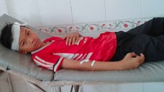 Quạt trần lại rơi trong lớp, 2 học sinh bị thương