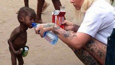 Sự hồi phục kỳ diệu của em bé “phù thủy” Nigeria