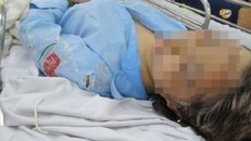 Vụ tạt axit nữ sinh ở Sài Gòn: 'Thợ xăm' tạt nhầm mục tiêu