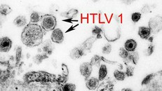 Virus cổ xưa có 'họ hàng với HIV' đột nhiên trỗi dậy