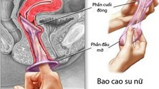 Bao cao su dành cho phái đẹp