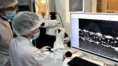 Việt Nam sản xuất thành công stent can thiệp tim mạch