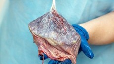 Thuốc làm từ thịt người, nhau thai người nguy hại thế nào?