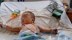 Em bé 1 tuổi bị suy thận do thói quen nấu nướng sai lầm của mẹ