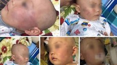 Hình ảnh bé trai bị bảo mẫu tát do gia đình cung cấp. Ảnh chụp lại.