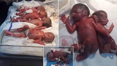 7 đứa trẻ chào đời khỏe mạnh dù sinh thường tự nhiên. Ảnh: Dailymail.