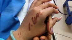 Nạn nhân bị tạt axit ở Quảng Ngãi: 'Tôi cứ tưởng là cướp'