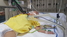 Bệnh nhi một tuổi bị suy hô hấp nặng do biến chứng sởi. Ảnh: Võ Thu.