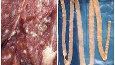 Bệnh sán lợn là do người bệnh ăn phải thức ăn bị ô nhiễm có nhiễm trứng sán dây lợn hoặc ấu trùng sán lợn (như thịt lợn gạo) chưa được nấu chín kỹ.