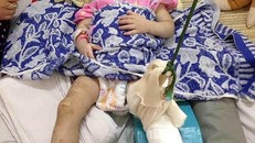 Cho rằng bé T. biếng ăn và hay quấy khóc, người mẹ nuôi đã đánh đập bé rất dã man khiến bé bị thương tật lên đến 58% 