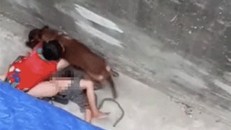 Bà Dương bị con chó becgie xông vào cắn gây đa chấn thương